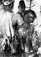 432px-Victim_of_Atomic_Bomb_of_Nagasaki_01.jpg